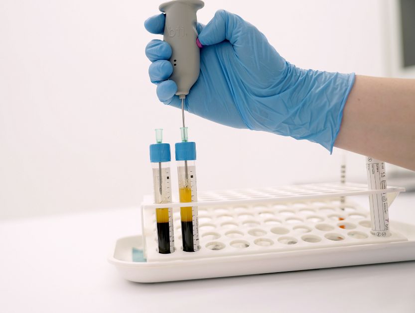 Ensayo clínico en hidradenitis supurativa Ensayo clínico en hidradenitis supurativa