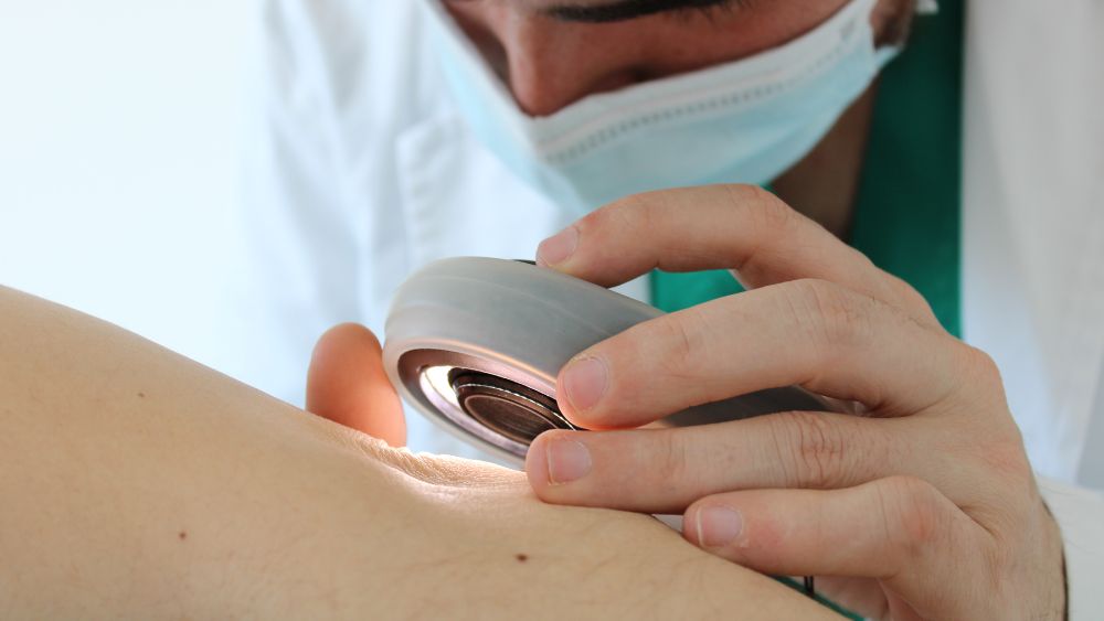 Ensayos clínicos en dermatología en Madrid