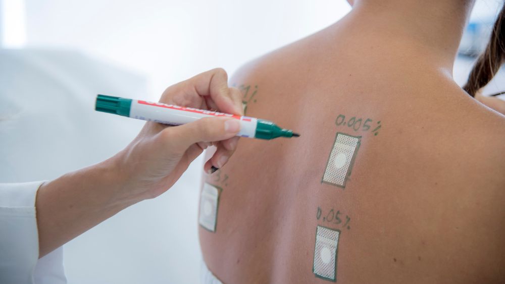 Nuevos tratamientos dermatológicos